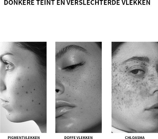 Gezichtsserum pigmentvlekken, doffe vlekken en chloasma