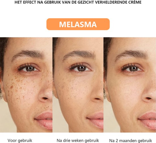 Pigment Crème before/after 