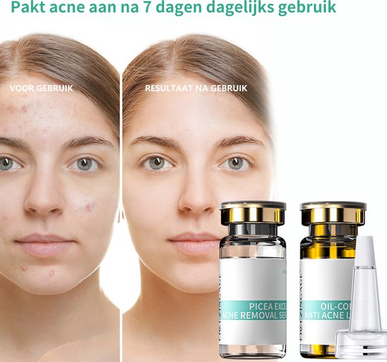 puistjesserum before/after 