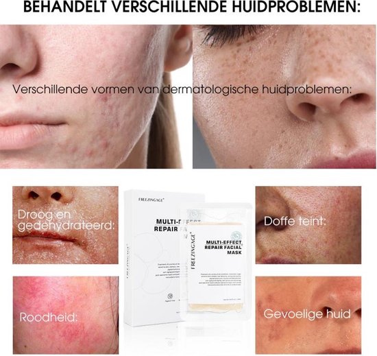 Gezichtsmasker wat het doet: