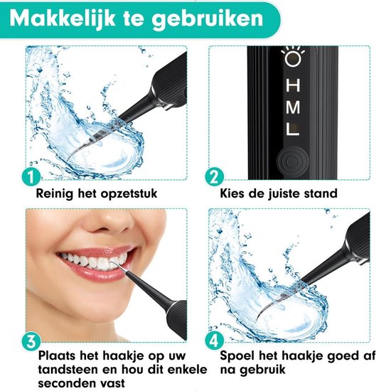 Tandsteen Verwijderaar stappenplan 