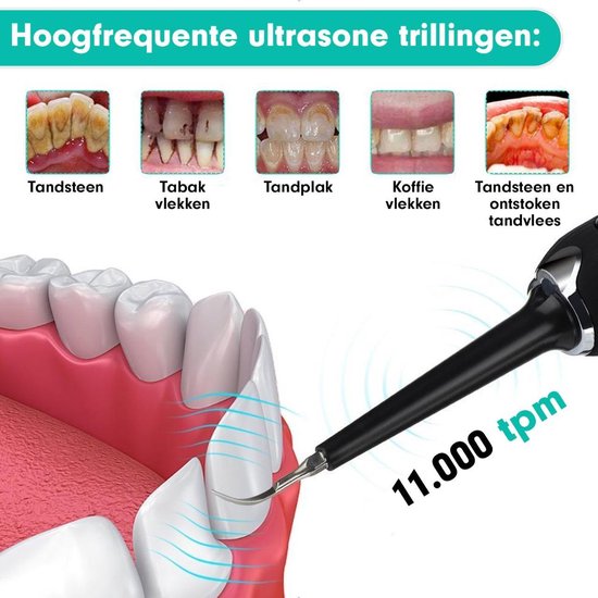 Tandsteen Verwijderaar ultrasone 
