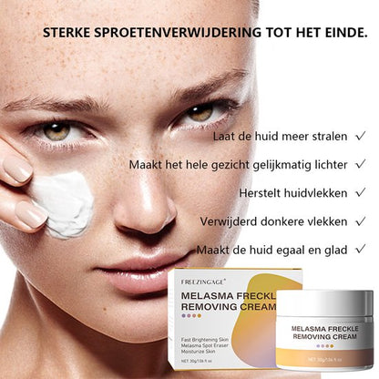 Anti-Pigment crème voordelen 