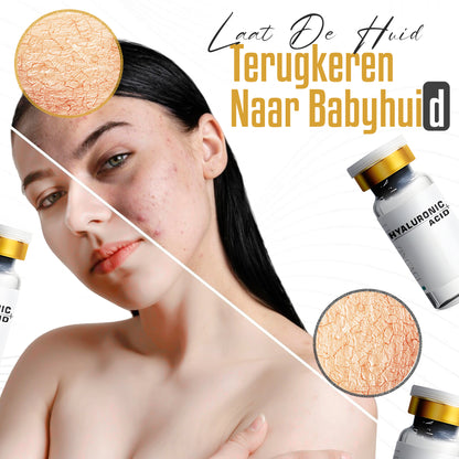 Freezing'Age Hyaluronzuur Serum - 40 ml.